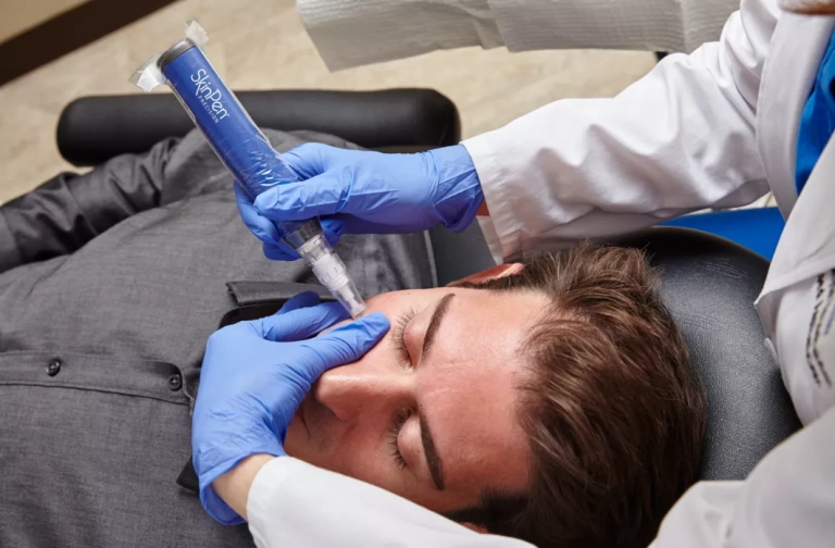 SkinPen Microneedling Treatment