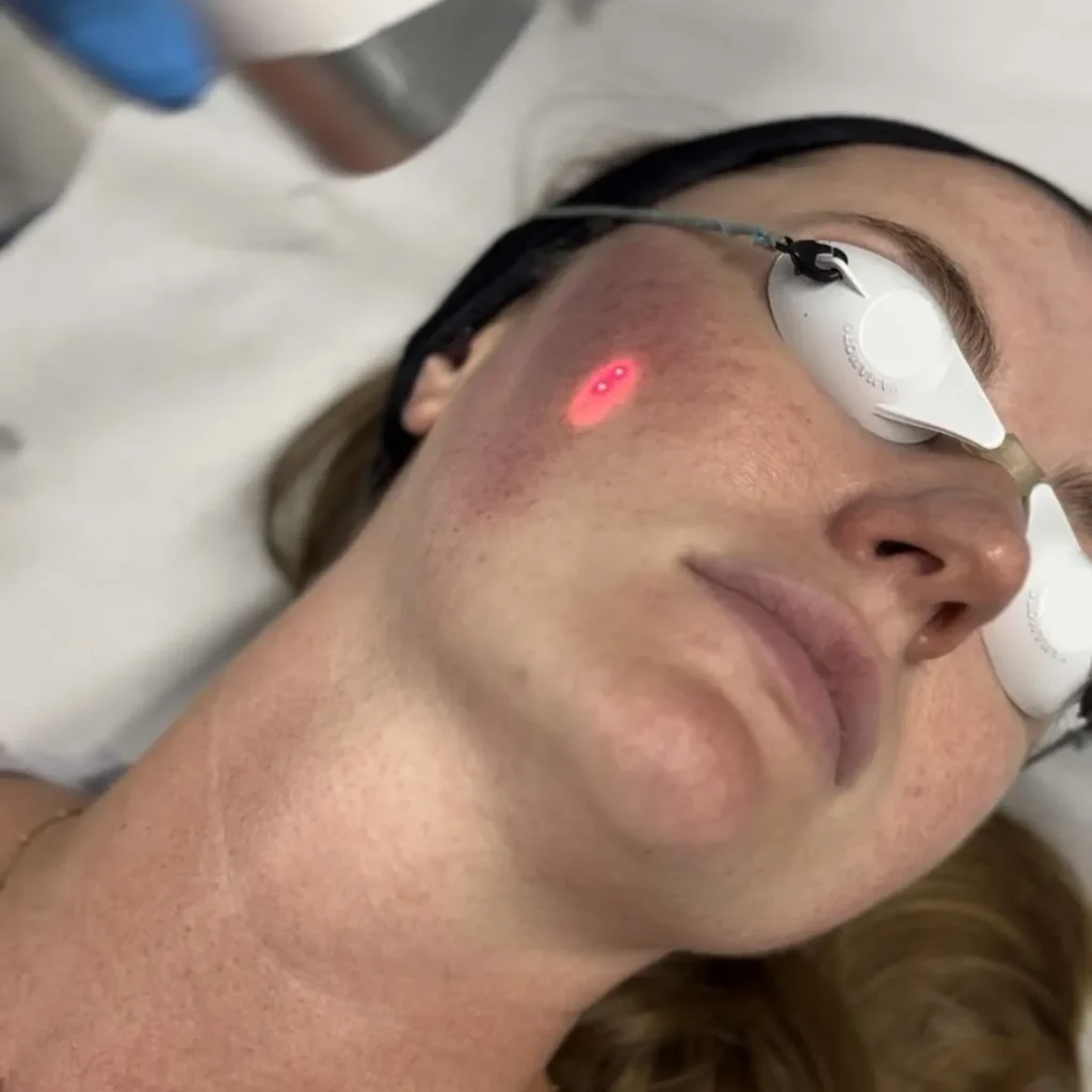 Broad Band Light - BBL™