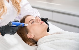 Illustrative image of SkinPen Microneedling