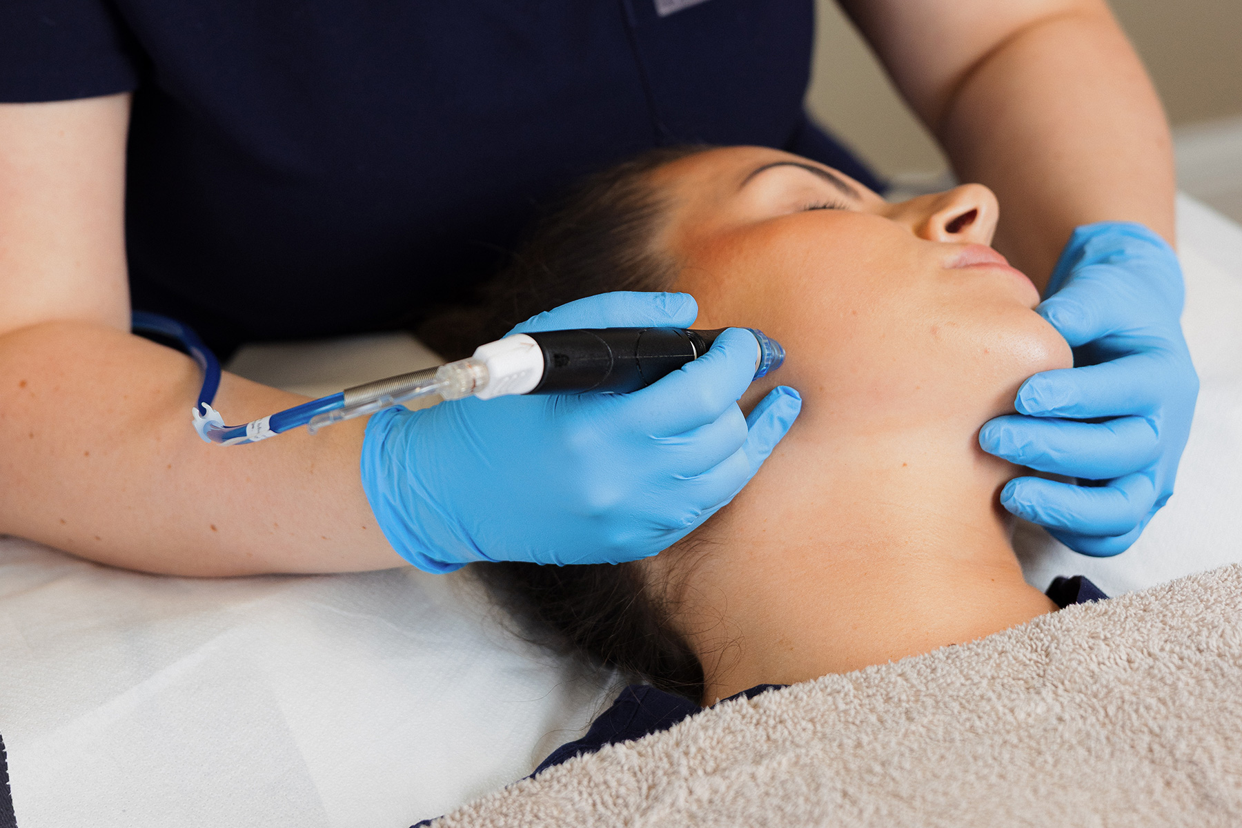 HydraFacial – Facial procedure at River Medical Dublin & Belfast