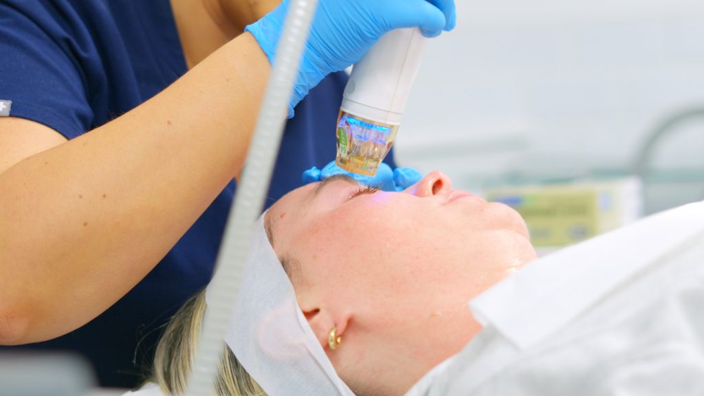 Secret RF Skin Tightening Treatment