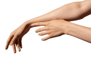 Illustrative image of Arm lift – Brachioplasty