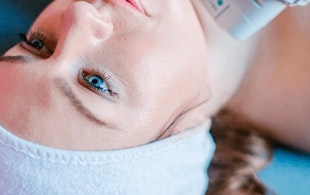 Illustrative image of Ultherapy – Skin Tightening