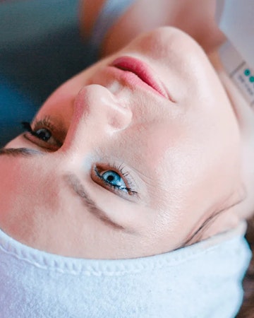 Illustrative image of Ultherapy – Skin Tightening