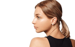 Illustrative image of Nose Surgery – Rhinoplasty