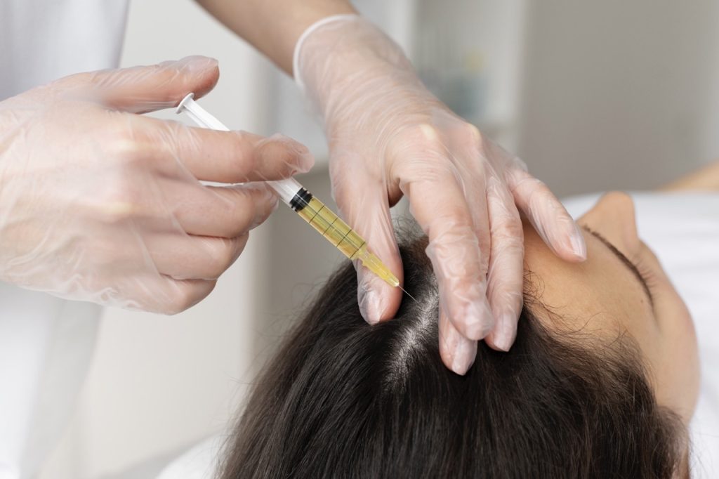PRP Thinning Hair Treatment